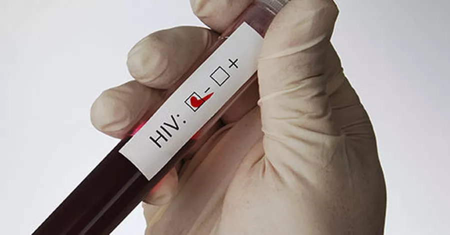 HIV-Test: Gewissheit nach sechs Wochen