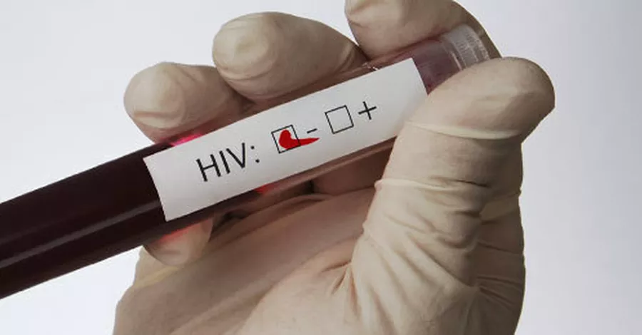 Soziale Netzwerke machen HIV-Tests attraktiv
